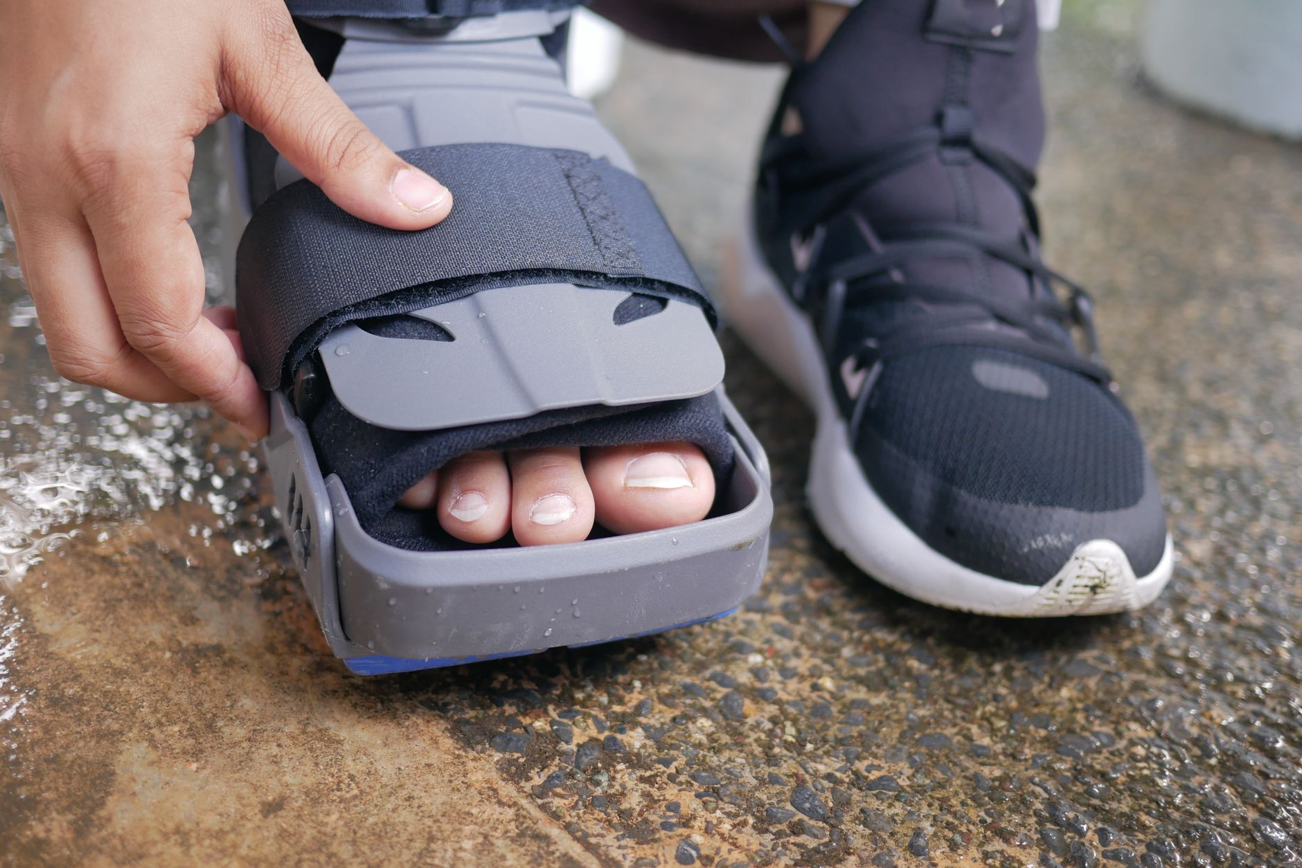 Ankle Surgery Recovery: Proven Tips for a Quick Comeback