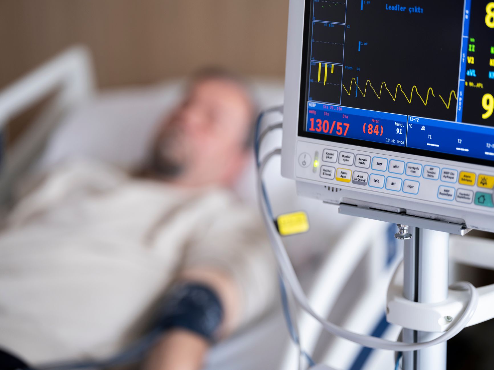 Stroke Rates in Adults: New Study Reveals Alarming Trend